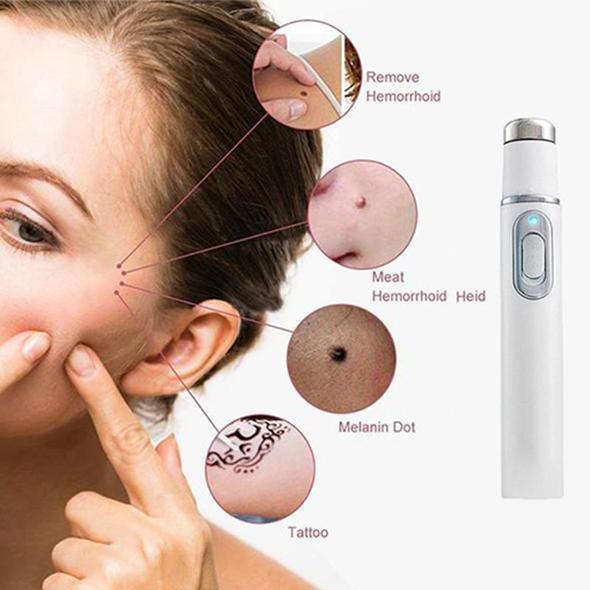 ClearNova Skin Spots Removal Pen – Blue Light Laser Spot Corrector for Home Use