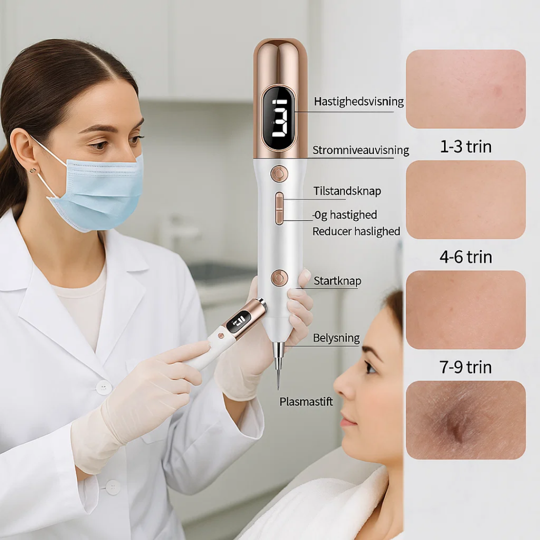 Skinova Plasma Pen – Precision Skin Spot Removal for Clear, Even-Looking Skin