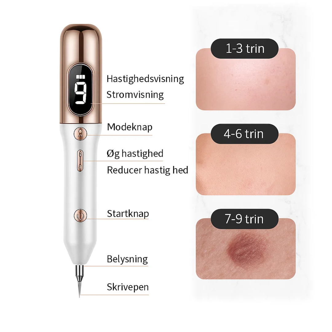 Skinova Plasma Pen – Precision Skin Spot Removal for Clear, Even-Looking Skin